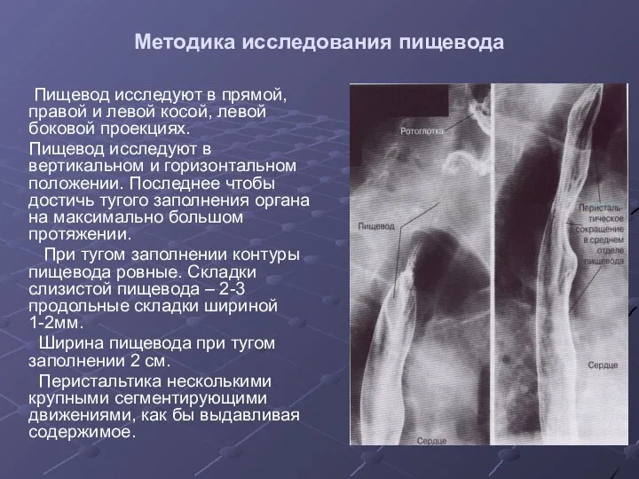 Методика исследования пищевода Пищевод исследуют в прямой, правой и левой косой,