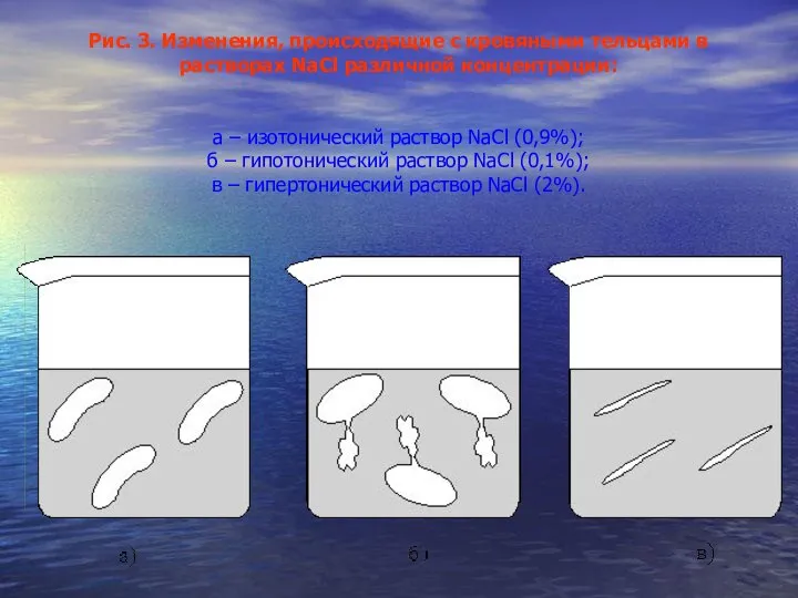 Рис. 3. Изменения, происходящие с кровяными тельцами в растворах NaCl различной