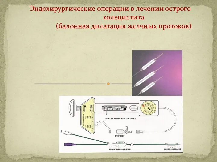 Эндохирургические операции в лечении острого холецистита (балонная дилатация желчных протоков)