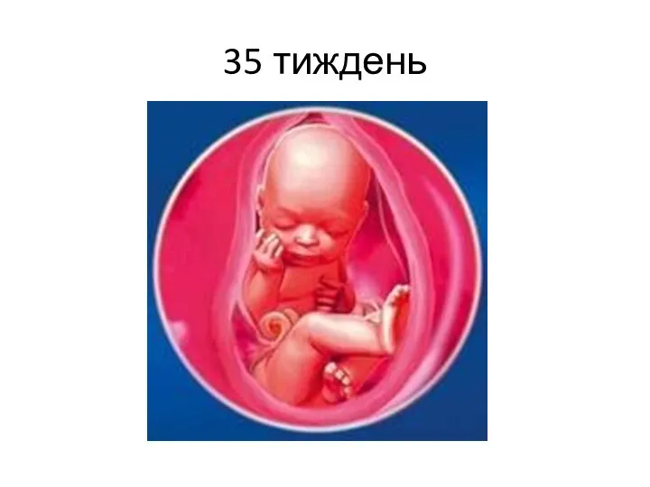 35 тиждень