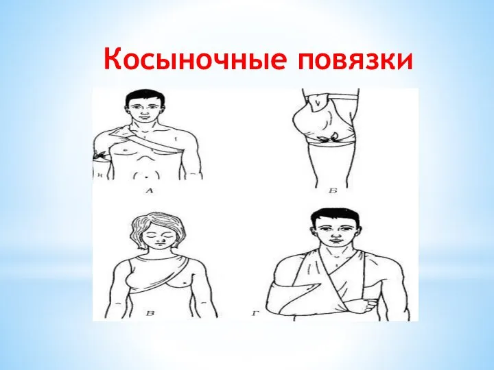 Косыночные повязки