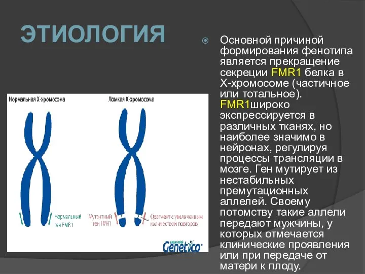 ЭТИОЛОГИЯ Основной причиной формирования фенотипа является прекращение секреции FMR1 белка в