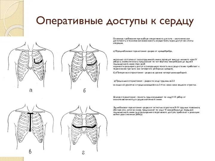 Оперативные доступы к сердцу Основные требования при выборе оперативного доступа –