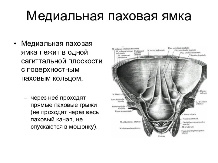 Медиальная паховая ямка Медиальная паховая ямка лежит в одной сагиттальной плоскости