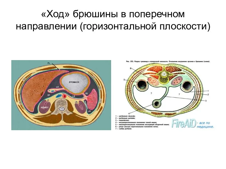 «Ход» брюшины в поперечном направлении (горизонтальной плоскости)