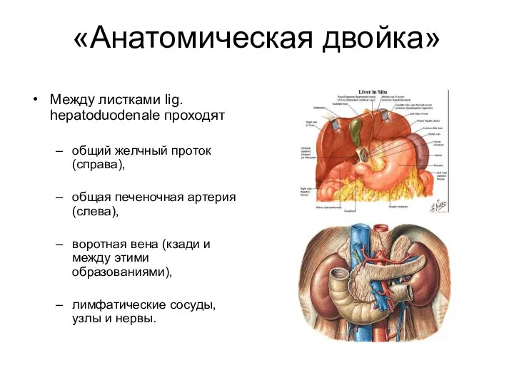 «Анатомическая двойка» Между листками lig. hepatoduodenale проходят общий желчный проток (справа),