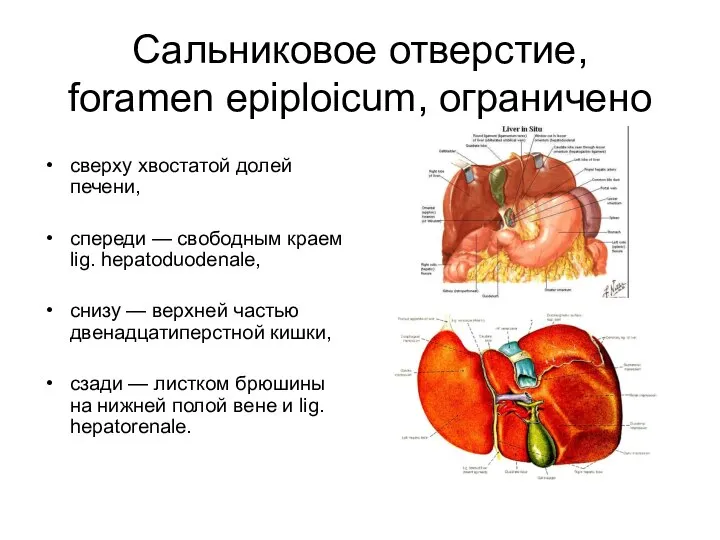 Сальниковое отверстие, foramen epiplоicum, ограничено сверху хвостатой долей печени, спереди —