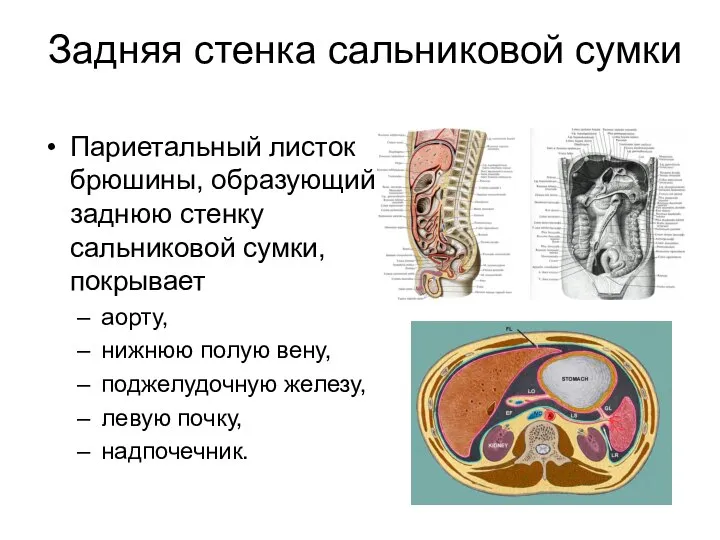 Задняя стенка сальниковой сумки Париетальный листок брюшины, образующий заднюю стенку сальниковой