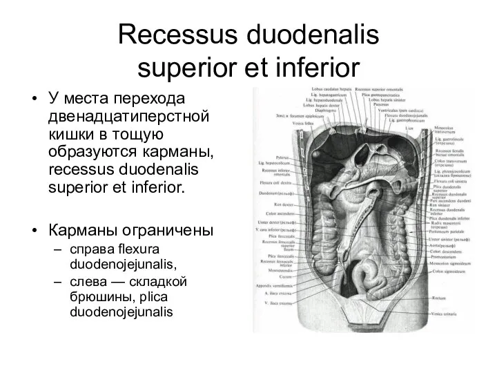 Recessus duodenalis superior et inferior У места перехода двенадцатиперстной кишки в