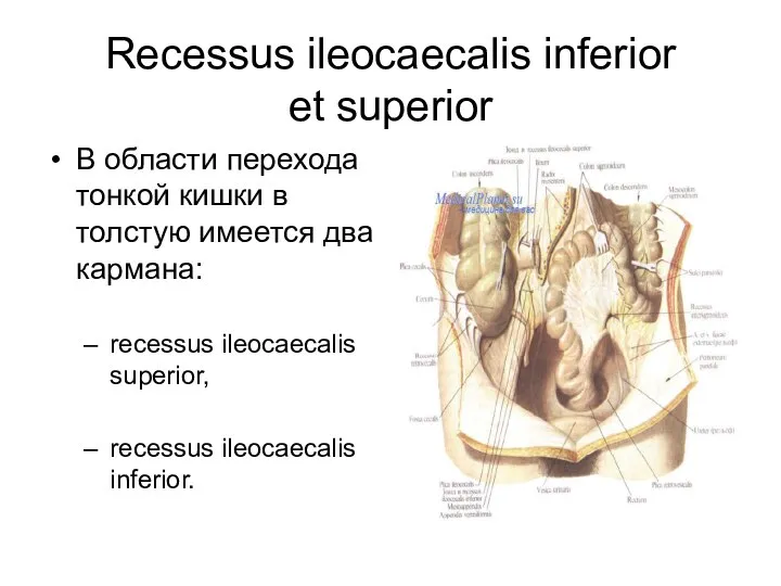 Recessus ileocaecаlis inferior et superior В области перехода тонкой кишки в