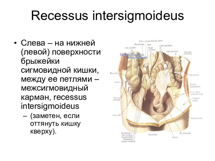 Recessus intersigmoideus Слева – на нижней (левой) поверхности брыжейки сигмовидной кишки,