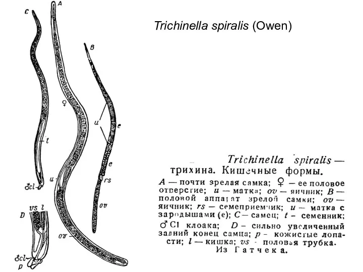 Trichinella spiralis (Owen)