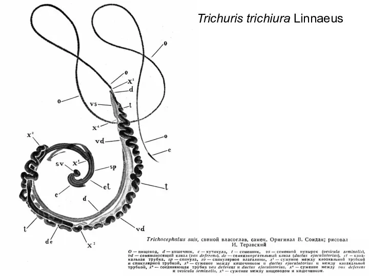 Trichuris trichiura Linnaeus