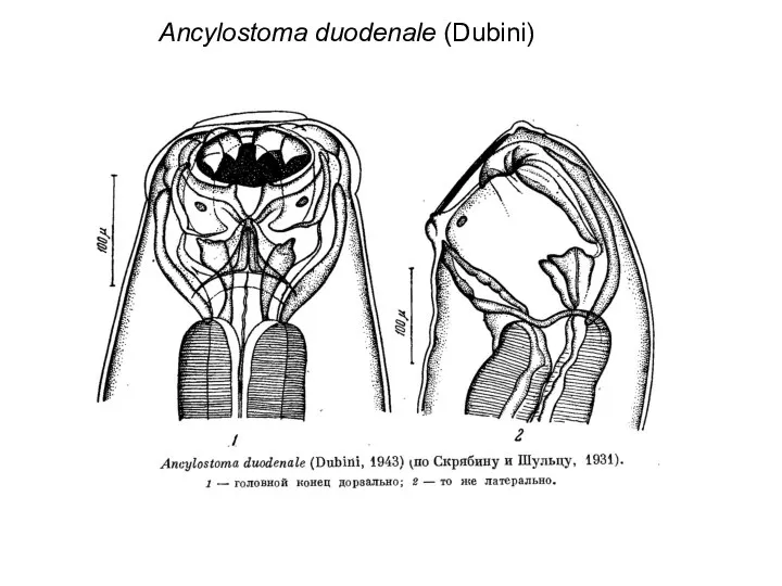 Ancylostoma duodenale (Dubini)