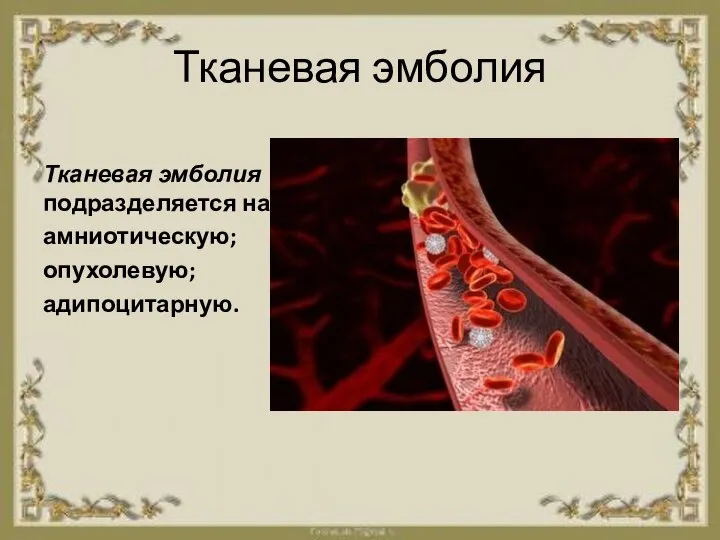 Тканевая эмболия Тканевая эмболия подразделяется на: амниотическую; опухолевую; адипоцитарную.