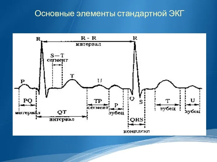 Основные элементы стандартной ЭКГ