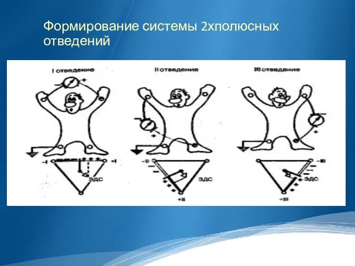 Формирование системы 2хполюсных отведений