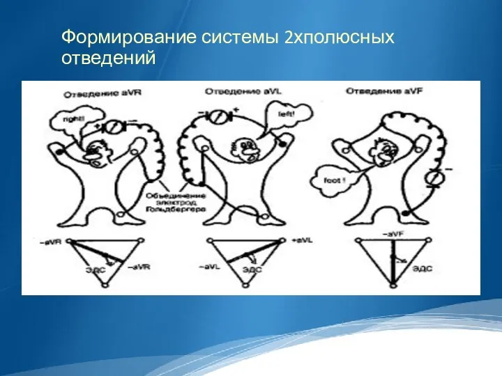 Формирование системы 2хполюсных отведений