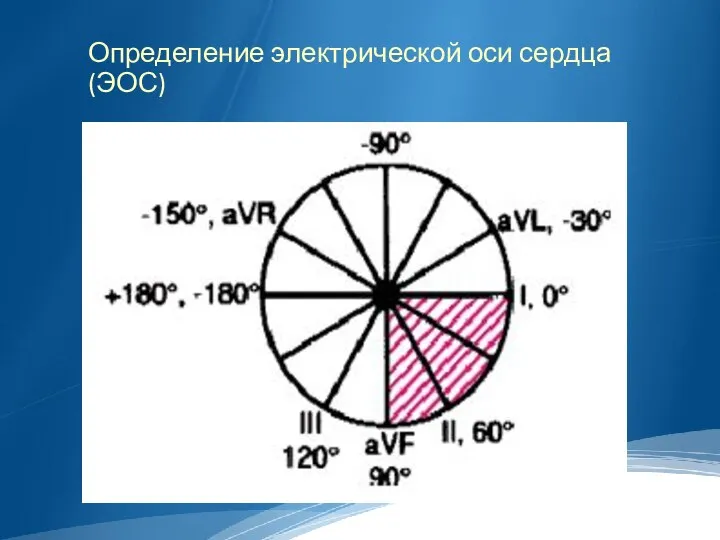 Определение электрической оси сердца (ЭОС)