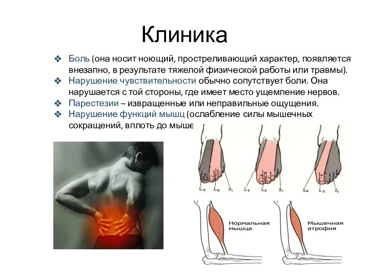 Клиника Боль (она носит ноющий, простреливающий характер, появляется внезапно, в результате