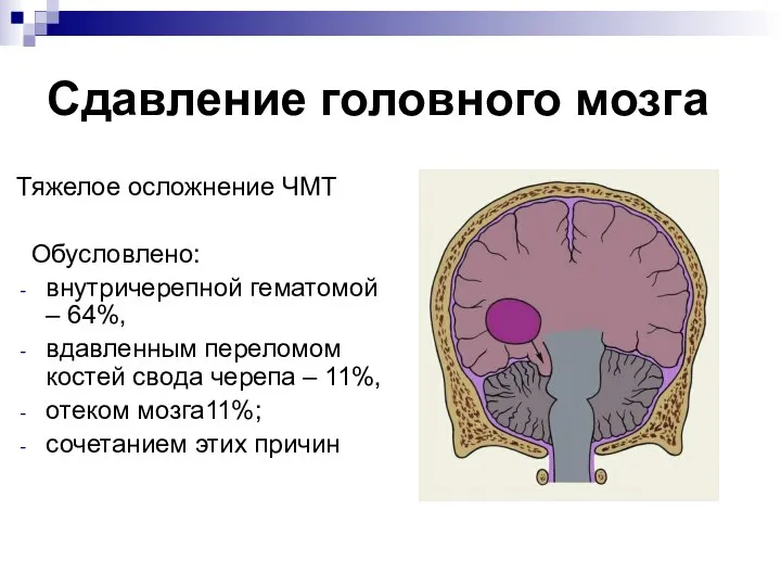 Сдавление головного мозга Тяжелое осложнение ЧМТ Обусловлено: внутричерепной гематомой – 64%,