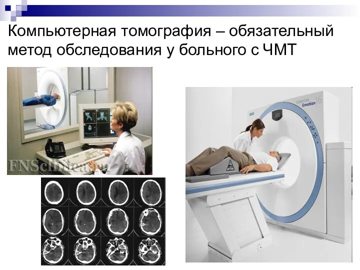 Компьютерная томография – обязательный метод обследования у больного с ЧМТ