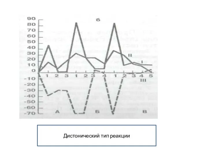 Дистонический тип реакции