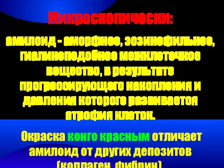 Микроскопически: амилоид - аморфное, эозинофильное, гиалиноподобное межклеточное вещество, в результате прогрессирующего