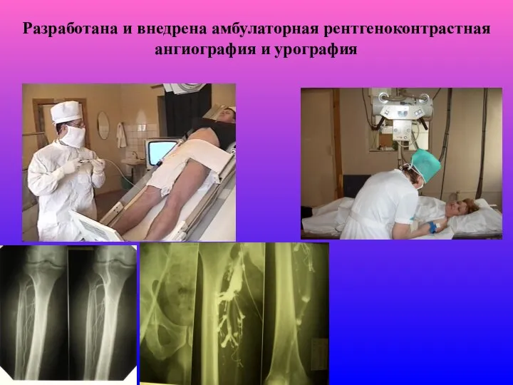 Разработана и внедрена амбулаторная рентгеноконтрастная ангиография и урография