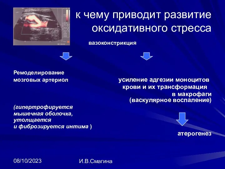 08/10/2023 И.В.Смагина к чему приводит развитие оксидативного стресса вазоконстрикция Ремоделирование мозговых