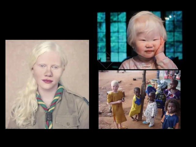 Пример подобных мутаций — альбинизм.