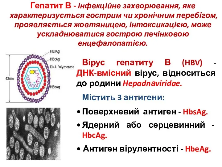 Гепатит В - інфекційне захворювання, яке характеризується гострим чи хронічним перебігом,