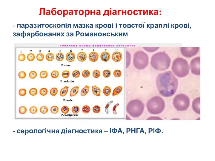 Лабораторна діагностика: - паразитоскопія мазка крові і товстої краплі крові, зафарбованих