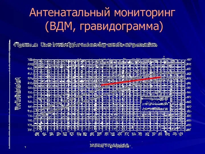 Антенатальный мониторинг (ВДМ, гравидограмма)