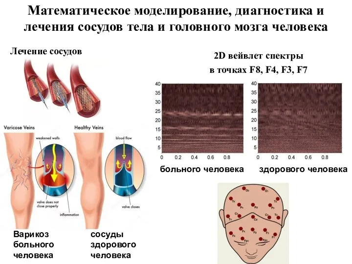 2D вейвлет спектры в точках F8, F4, F3, F7 здорового человека