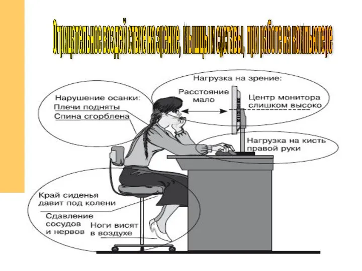 Отрицательное воздей ствие на зрение, мышцы и суставы, при работе на компьютере