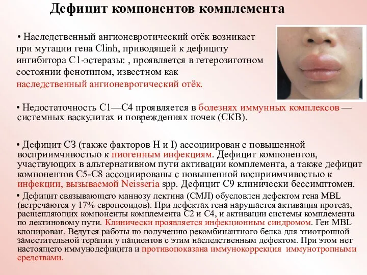 Дефицит компонентов комплемента • Наследственный ангионевротический отёк возникает при мутации гена