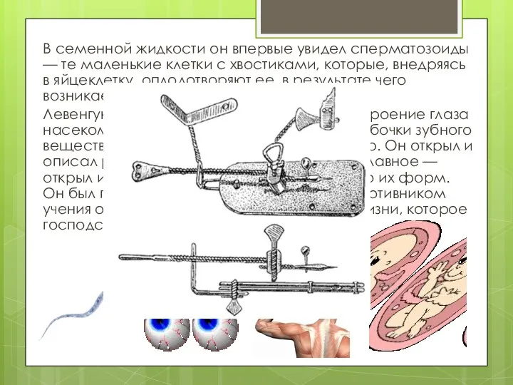 В семенной жидкости он впервые увидел сперматозоиды — те маленькие клетки