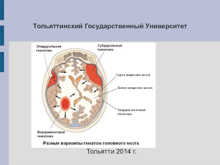 Тольяттинский Государственный Университет Тольятти 2014 г.