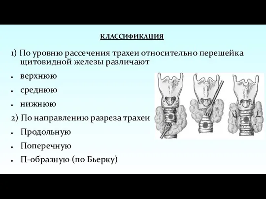 КЛАССИФИКАЦИЯ 1) По уровню рассечения трахеи относительно перешейка щитовидной железы различают