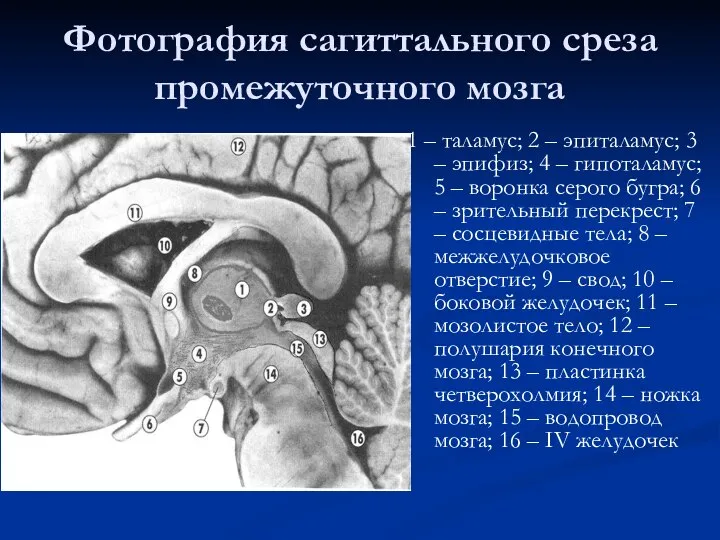 Фотография сагиттального среза промежуточного мозга 1 – таламус; 2 – эпиталамус;