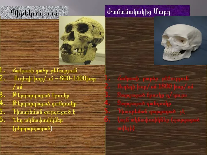 Ճակատի ցածր թեքություն Ուղեղի խոր/սմ – 800-1400խոր /սմ Թերզարգացած քթոսկր Թերզարգացած