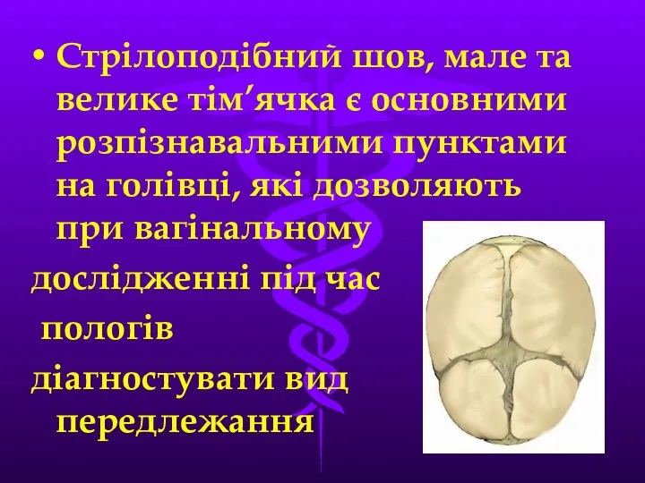 Стрiлоподiбний шов, мале та велике тiм’ячка є основними розпiзнавальними пунктами на