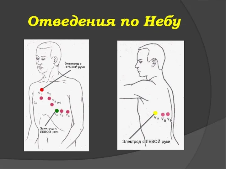 Отведения по Небу