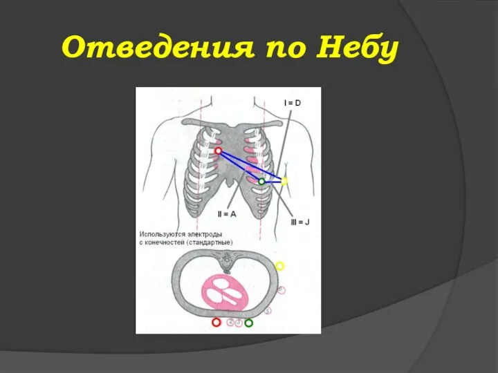 Отведения по Небу