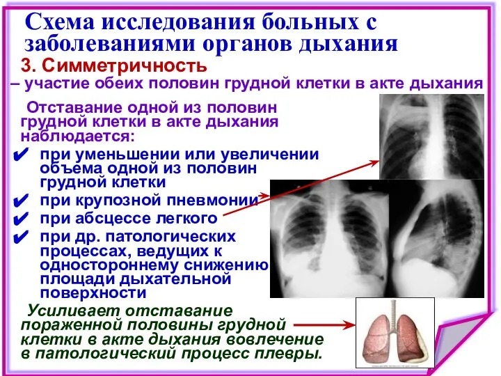 Схема исследования больных с заболеваниями органов дыхания Отставание одной из половин