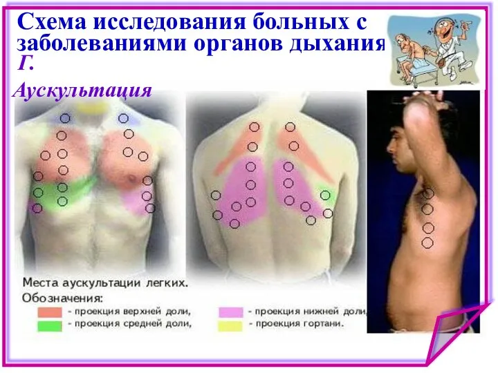 Схема исследования больных с заболеваниями органов дыхания Г. Аускультация