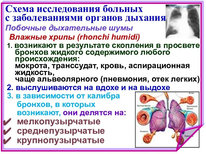 Схема исследования больных с заболеваниями органов дыхания Побочные дыхательные шумы Влажные