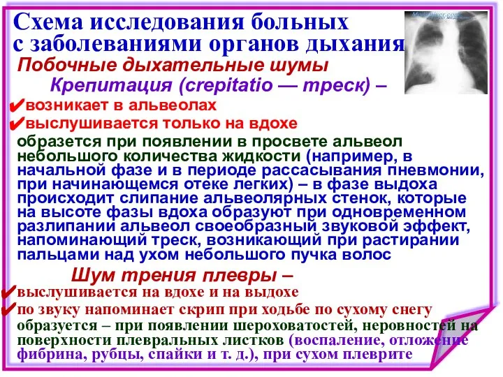 Схема исследования больных с заболеваниями органов дыхания Побочные дыхательные шумы Крепитация