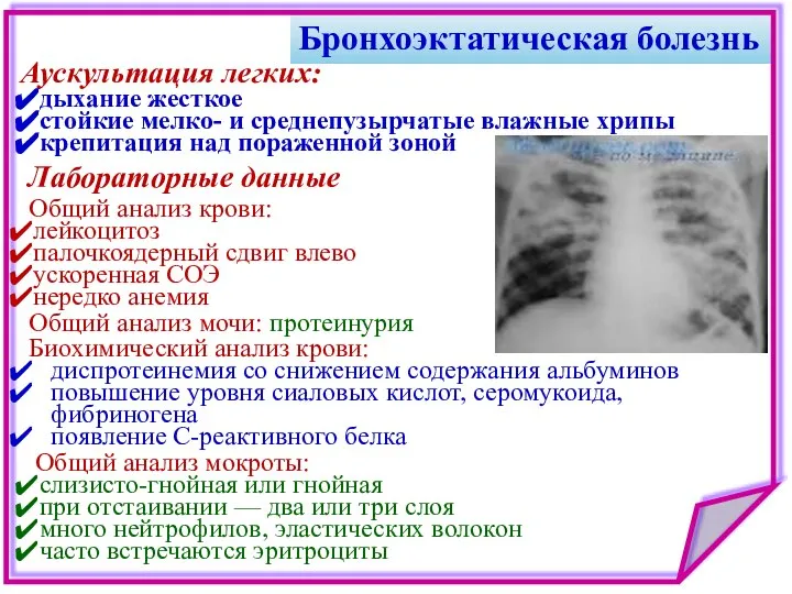 Бронхоэктатическая болезнь Лабораторные данные Общий анализ крови: лейкоцитоз палочкоядерный сдвиг влево